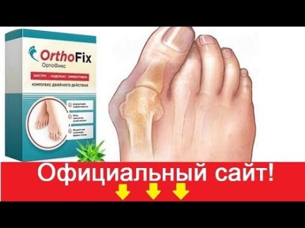 OrthoFix — Препарат проти вальгусної деформації стопи ОртоФікс