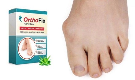 OrthoFix — Препарат проти вальгусної деформації стопи ОртоФікс