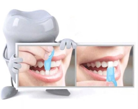 Комплект для вибілювання зубів Teeth Cleaning Kit