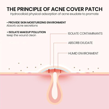 Патч гідрогелевий Pipmples Acne Skin Tag Patches проти вугрів, акне, прищів, бородавок і запалень 200 шт./1 уп