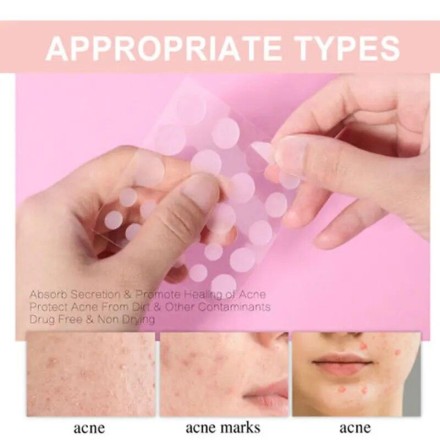Патч гідрогелевий The Look Of Comedo Acne Skin Tag Patches від вугрів, акне, прищів, бородавок, комедон 72 шт.