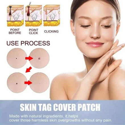 Патч гідрогелевий The Look Of Comedo Acne Skin Tag Patches від вугрів, акне, прищів, бородавок, комедон 72 шт.