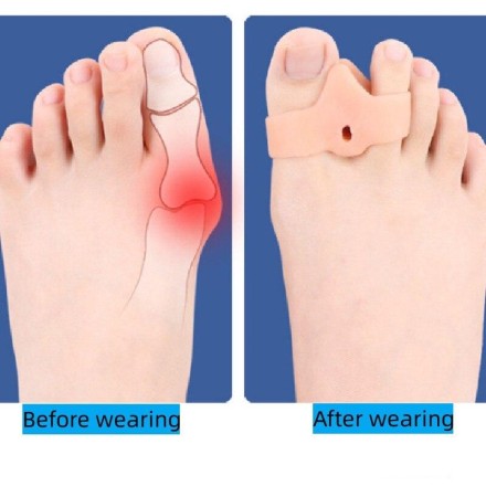 Вальгусна шина Hallux Valgus. Коректор великого пальця силіконовий