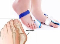 Бандаж на великий палець ноги Goodnight Bunion вальгусний фіксатор на ніч