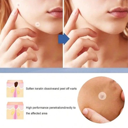 Патч гідрогелевий EELHOE Acne Skin Tag Patches проти вугрів, акне, прищів, бородавок і запалень 144 шт./1 уп