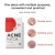 Патчі Kormesic Acne Patch від акне та запалень 36 шт./1 уп