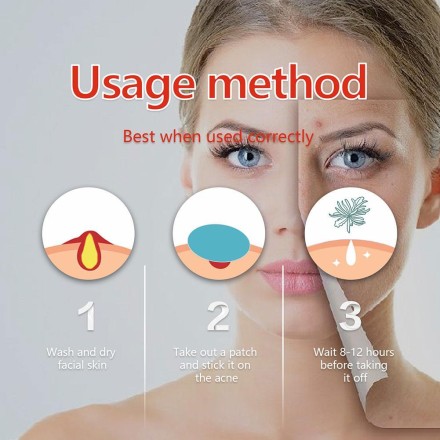 Патчі Kormesic Acne Patch від акне та запалень 36 шт./1 уп